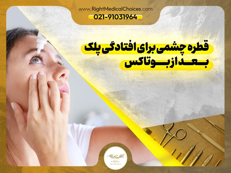 قطره چشمی برای افتادگی پلک بعد از بوتاکس