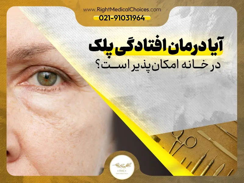 آیا درمان افتادگی پلک در خانه امکان‌پذیر است؟