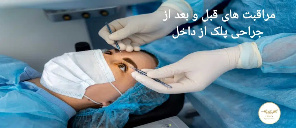 مراقبت‌های قبل از جراحی پلک