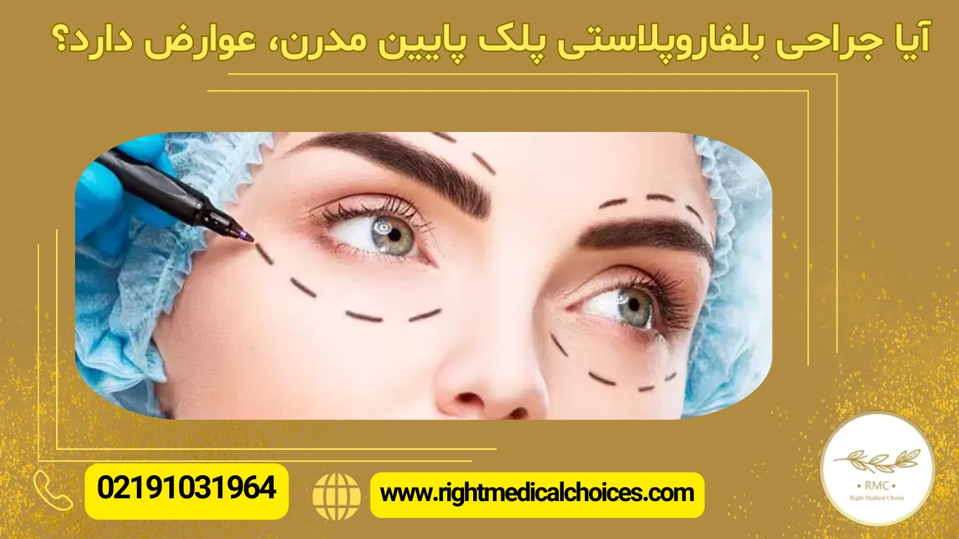 جراحی پلک پایین مدرن