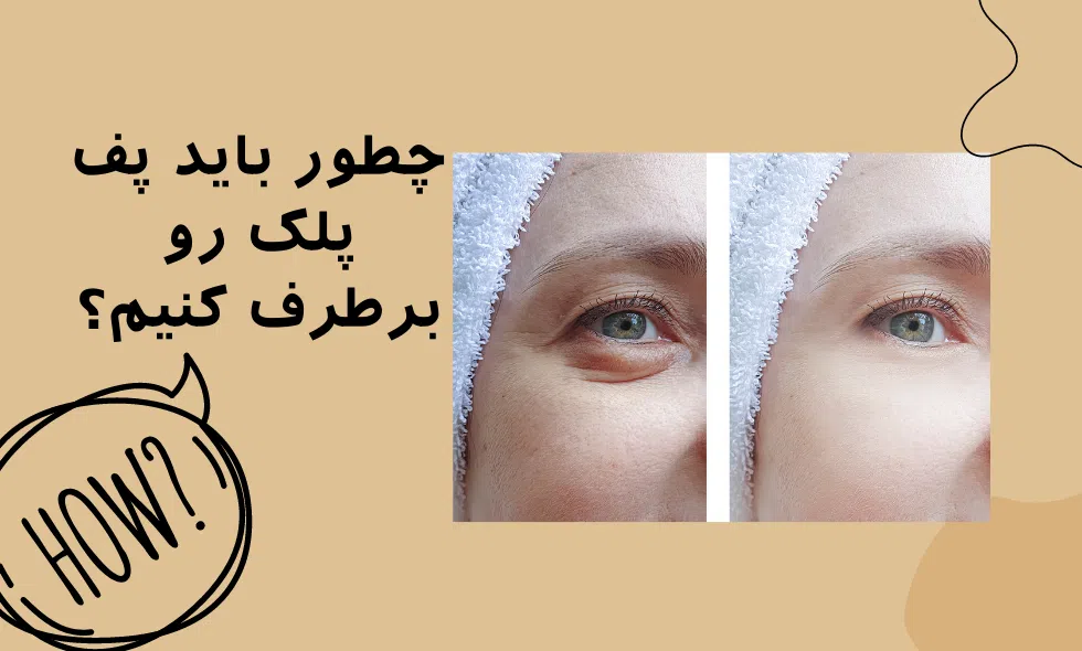 راه های برطرف کردن پف پلک