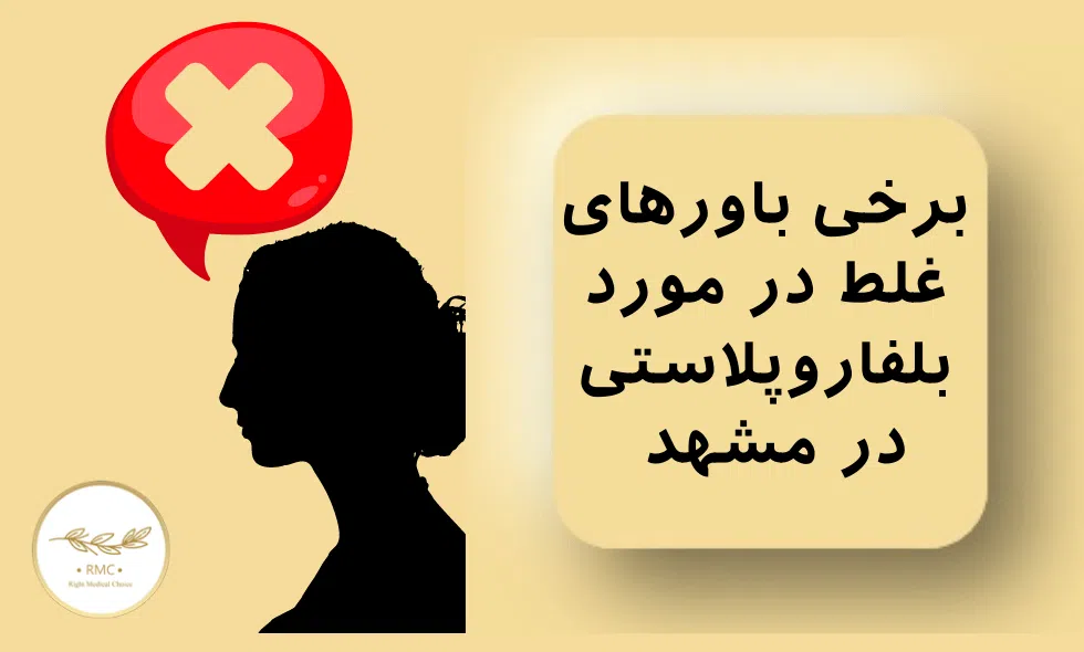 باورهای غلط در مورد بلفاروپلاستی در مشهد