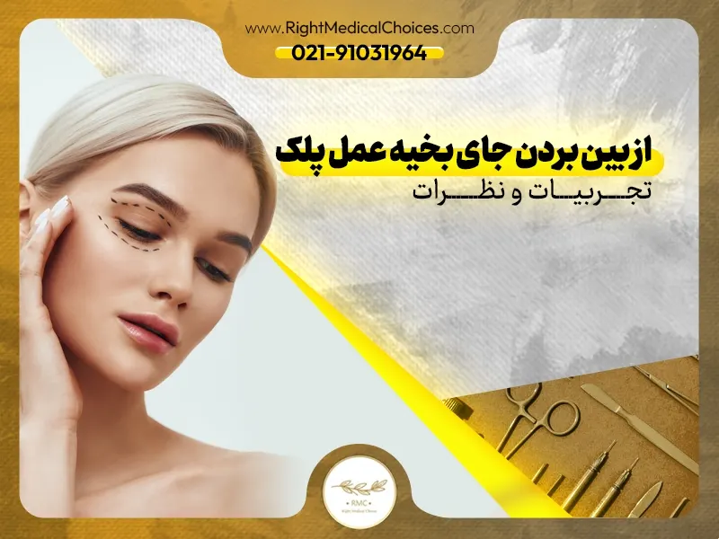 از بین بردن جای بخیه عمل پلک: تجربیات و نظرات