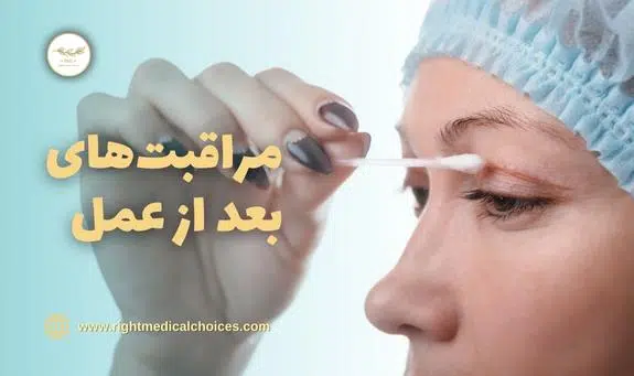 مراقبت های بعد از عمل بلفاروپلاستی | تجربه ها در نی نی سایت