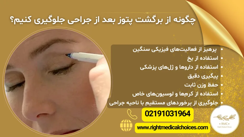 چگونه از برگشت پتوز جلوگیری کنیم؟
