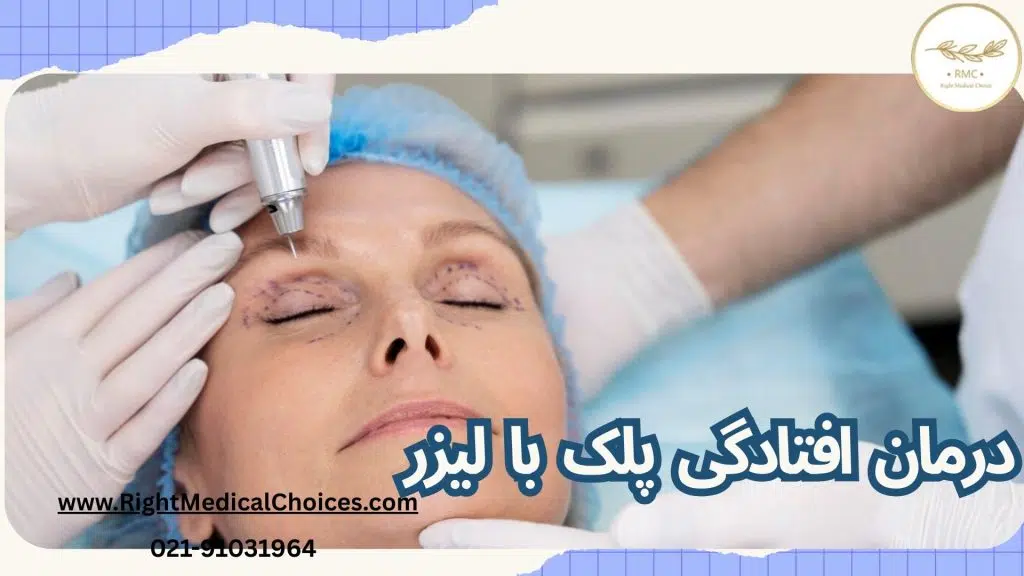 جدیدترین درمان پتوز چشم: درمان افتادگی پلک با لیزر