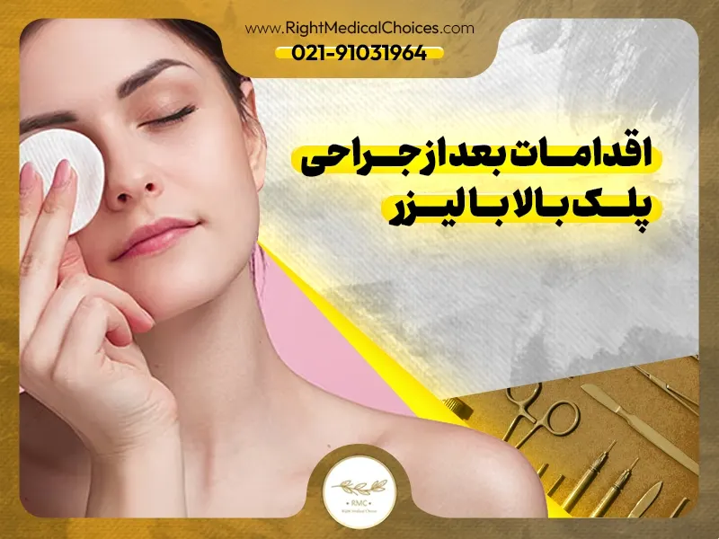 اقدامات بعد از جراحی پلک بالا با لیزر