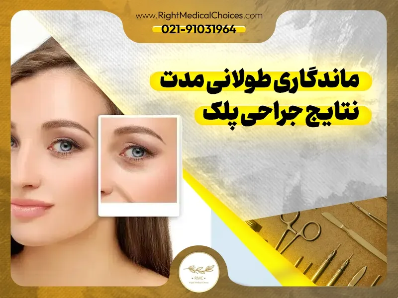 ماندگاری طولانی مدت نتایج جراحی پلک