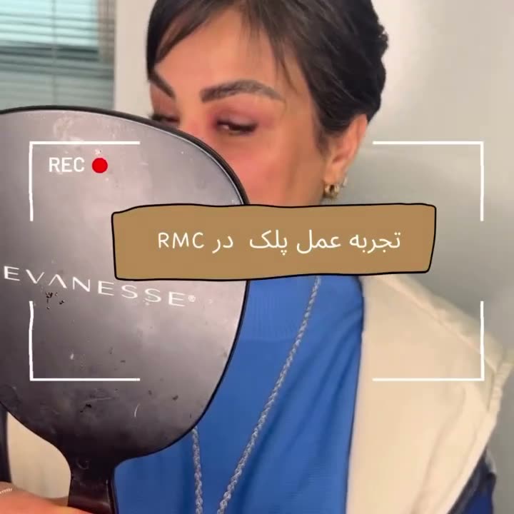 تصویر پیش‌نمایش ویدئوی بلفاروپلاستی در RMC — 31