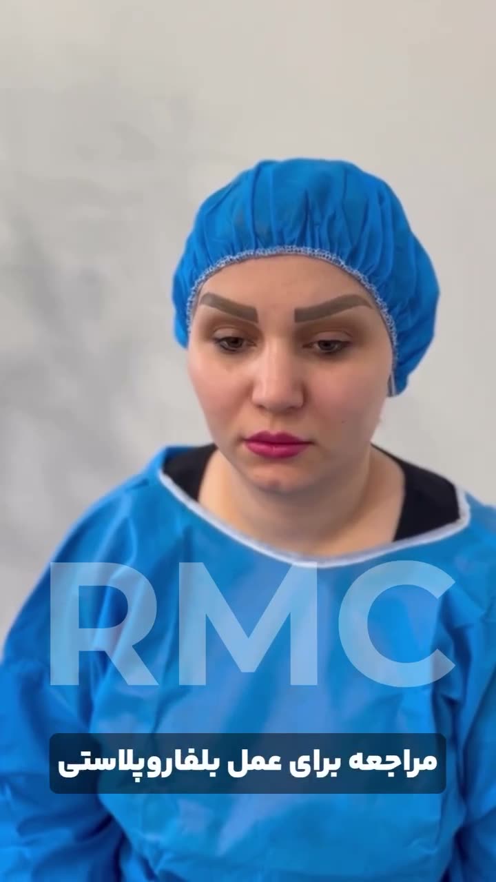 تصویر پیش‌نمایش ویدئوی بلفاروپلاستی در RMC — 38