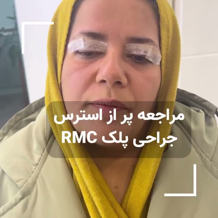 تصویر پیش‌نمایش ویدئوی بلفاروپلاستی در RMC — 32