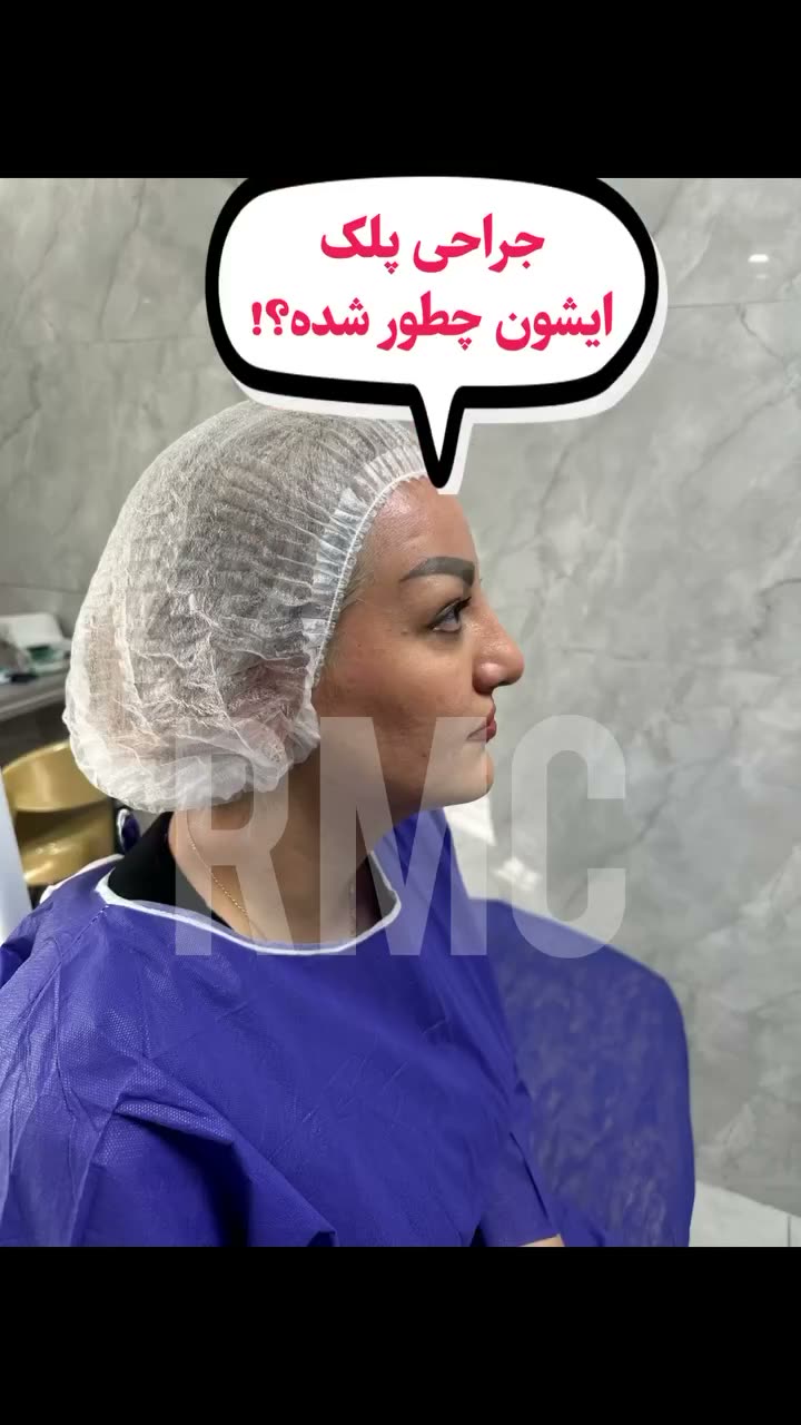 تصویر پیش‌نمایش تجربه دوره بهبود پس از جراحی پلک در RMC — 16
