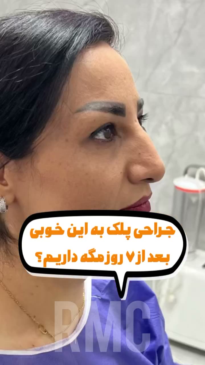 تصویر پیش‌نمایش ویدئوی بلفاروپلاستی در RMC — 34