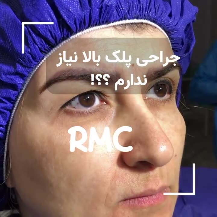 تصویر پیش‌نمایش ویدئوی جراحی پلک بالا در RMC — 6