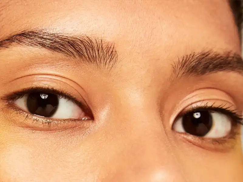 نتایج و دوره بهبودی عمل پلک سوم