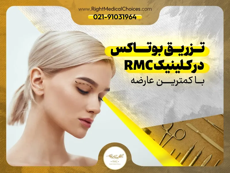 تزریق بوتاکس در کلینیک RMC با کمترین عارضه