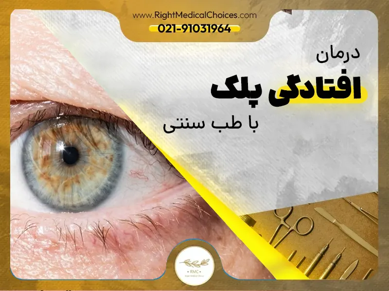 درمان خانگی پتوز پلک