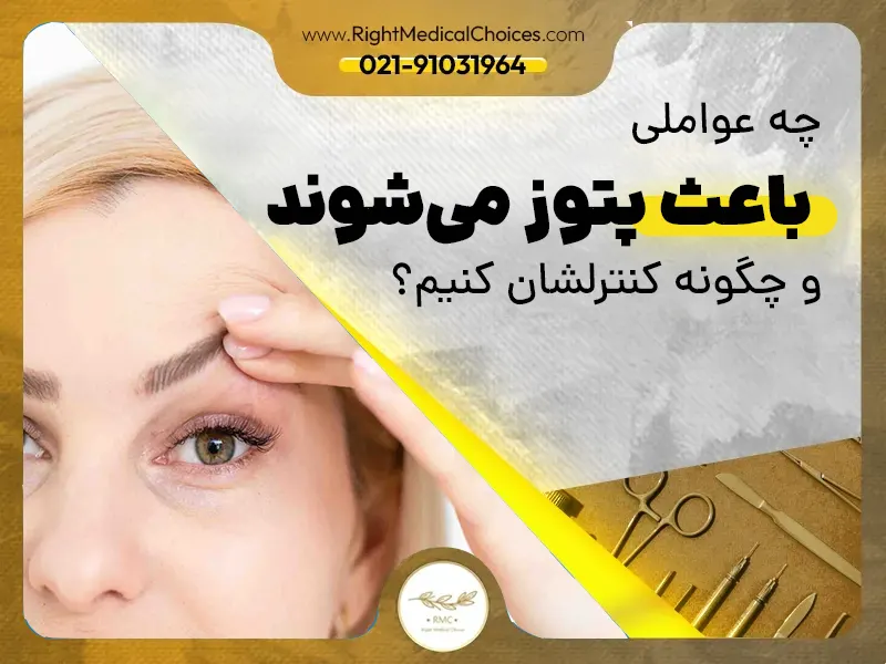 چه عواملی باعث پتوز می شوند؟